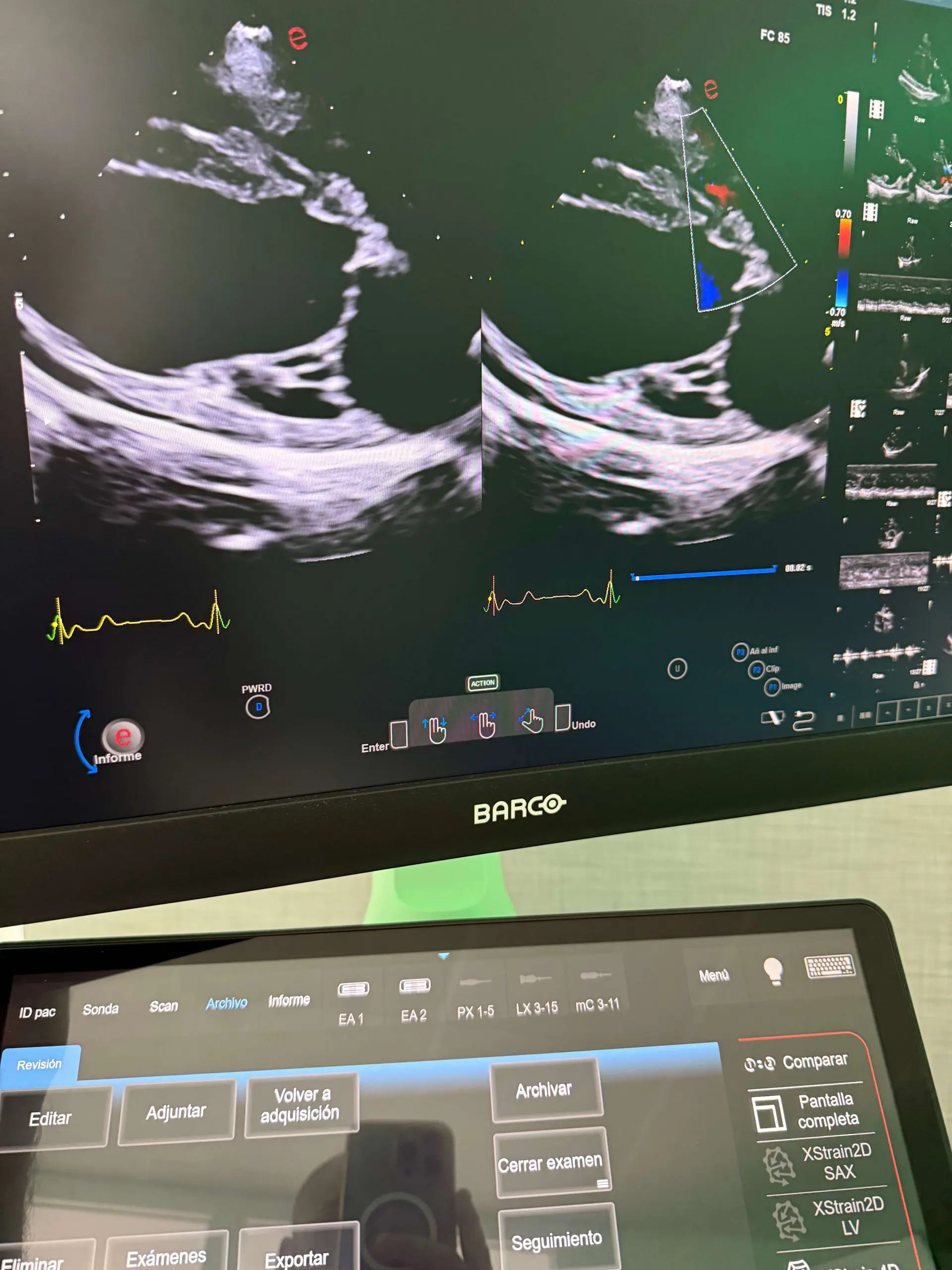 Ecocardiografia scaled