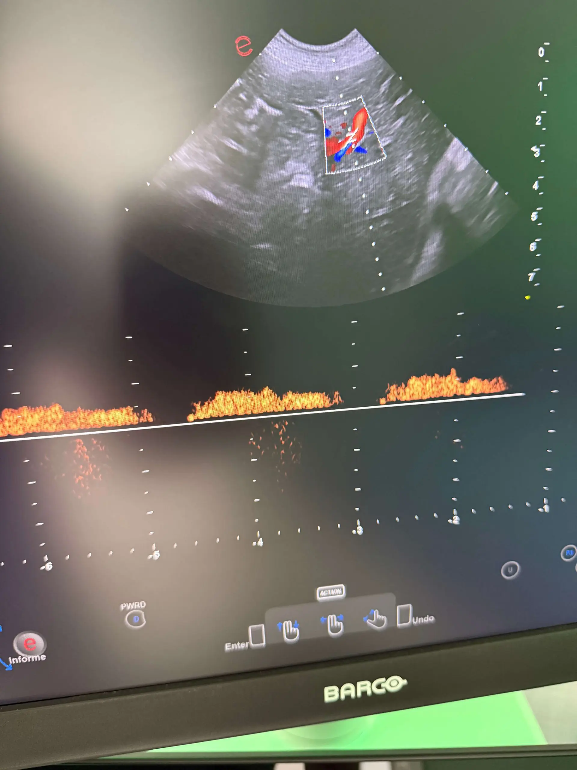 Ecografiadoppler scaled