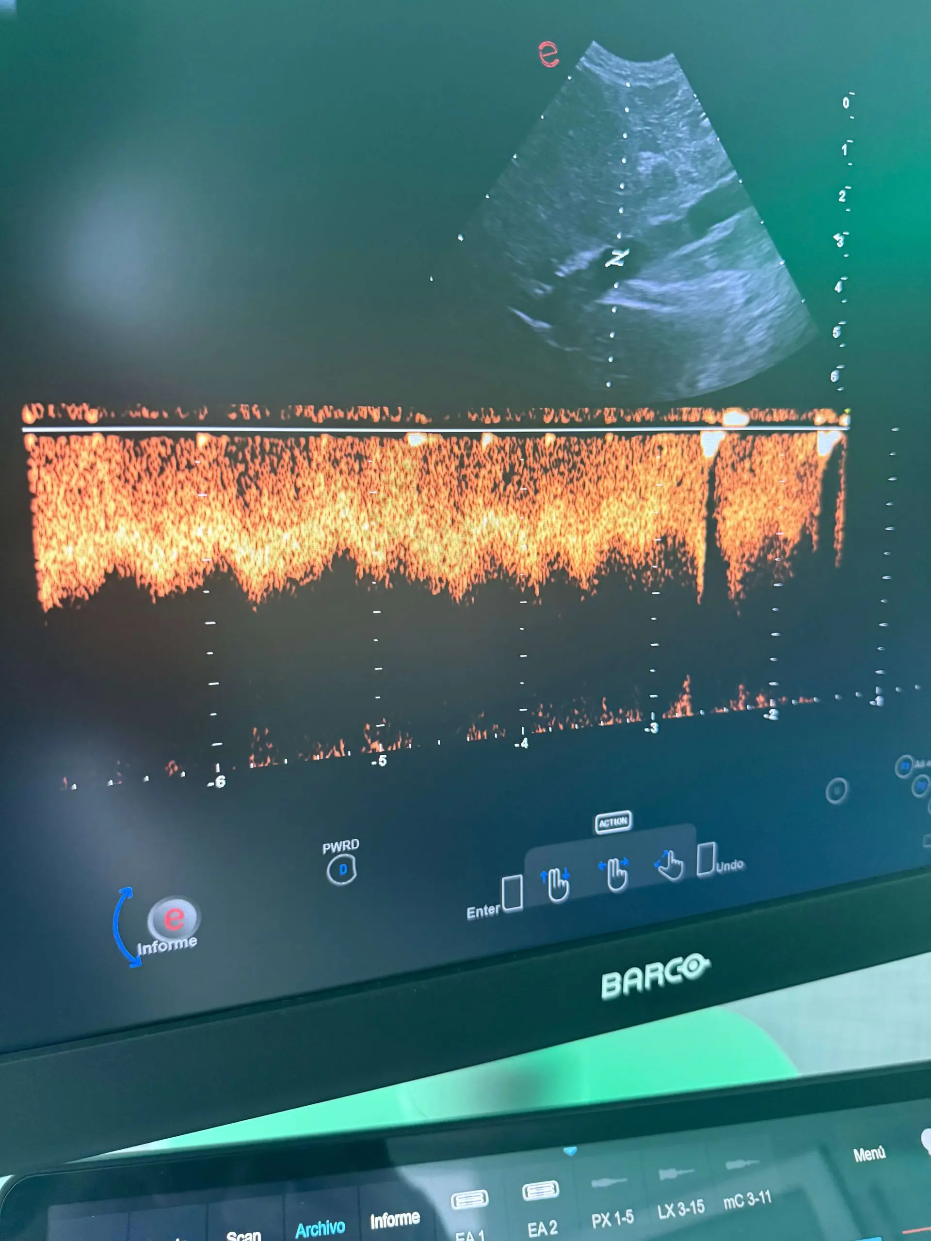 Ecografiadopplervascular scaled